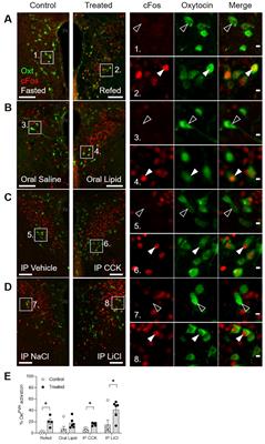 Paraventricular oxytocin neurons impact energy intake and expenditure: projections to the bed nucleus of the stria terminalis reduce sucrose consumption